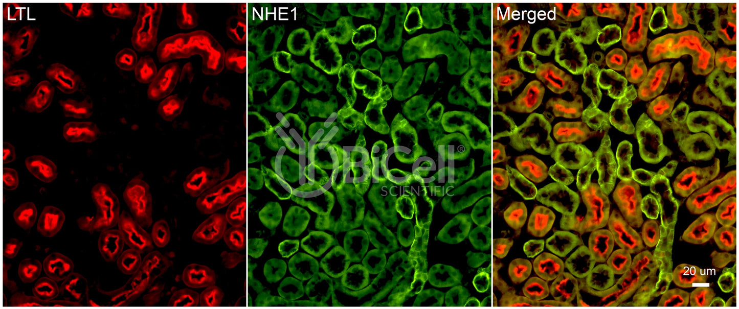 NHE1 (Slc9a1) Antibody - Western Blot Validated