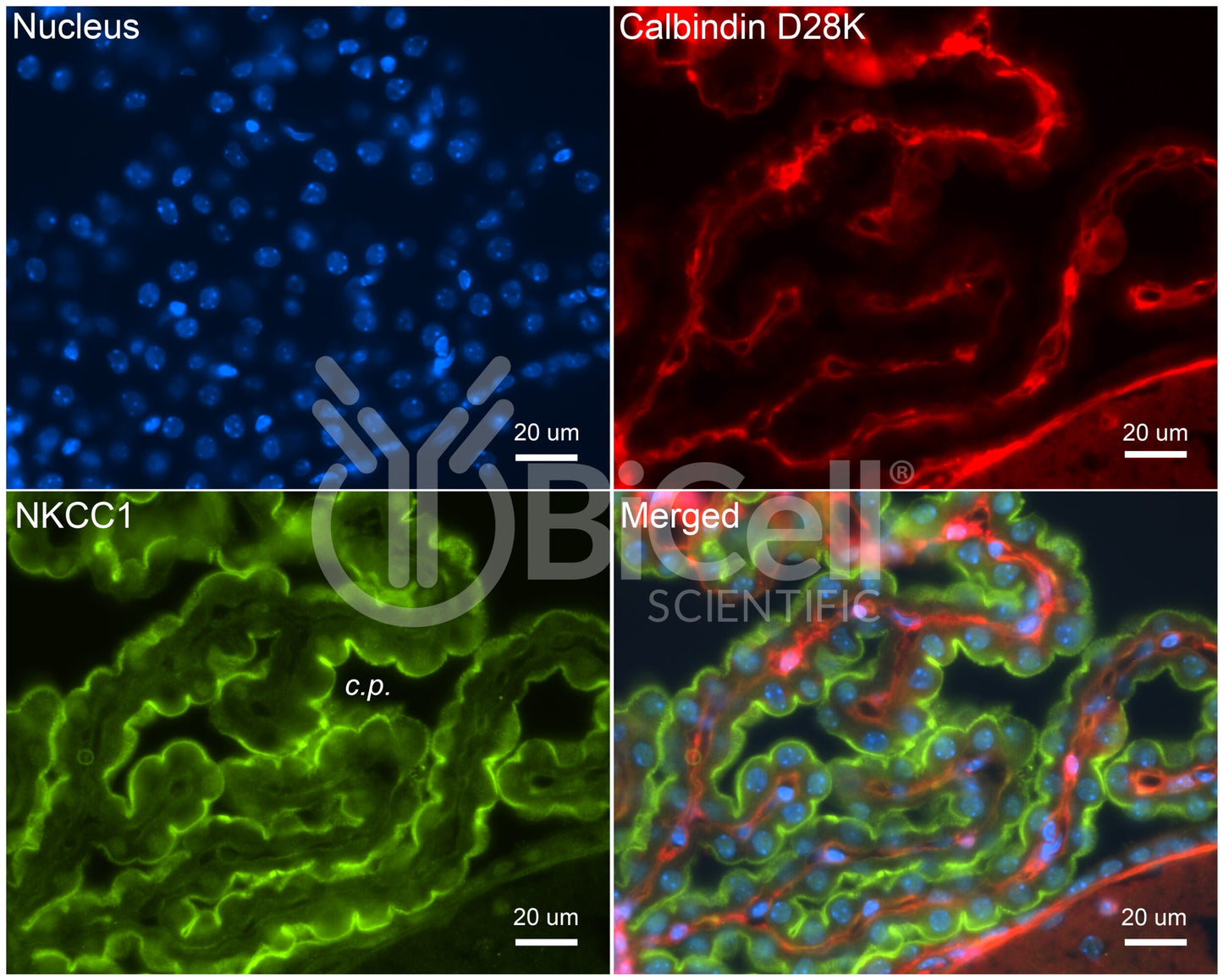NKCC1 (Slc12a2) Antibody - FFPE Validated