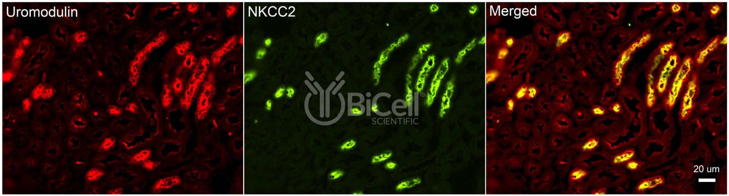 NKCC2 (Slc12a1) Antibody - FFPE Validated