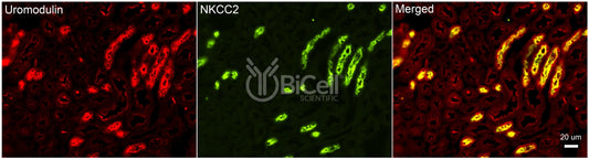 NKCC2 (Slc12a1) Antibody - FFPE Validated