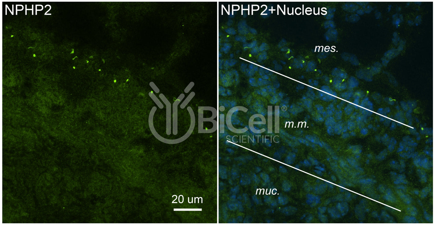 Nephrocystin-2 (NPHP2 or Inversin or INVS) Antibody - FFPE Validated
