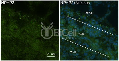 Nephrocystin-2 (NPHP2 or Inversin or INVS) Antibody