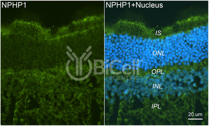 Nephrocystin-1 (NPHP1) Antibody