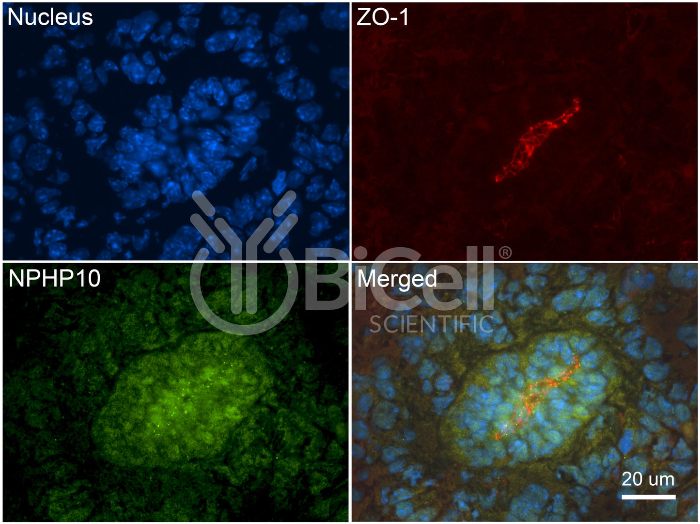 Nephrocystin-10 (NPHP10 or SDCCAG8 or BBS16) Antibody
