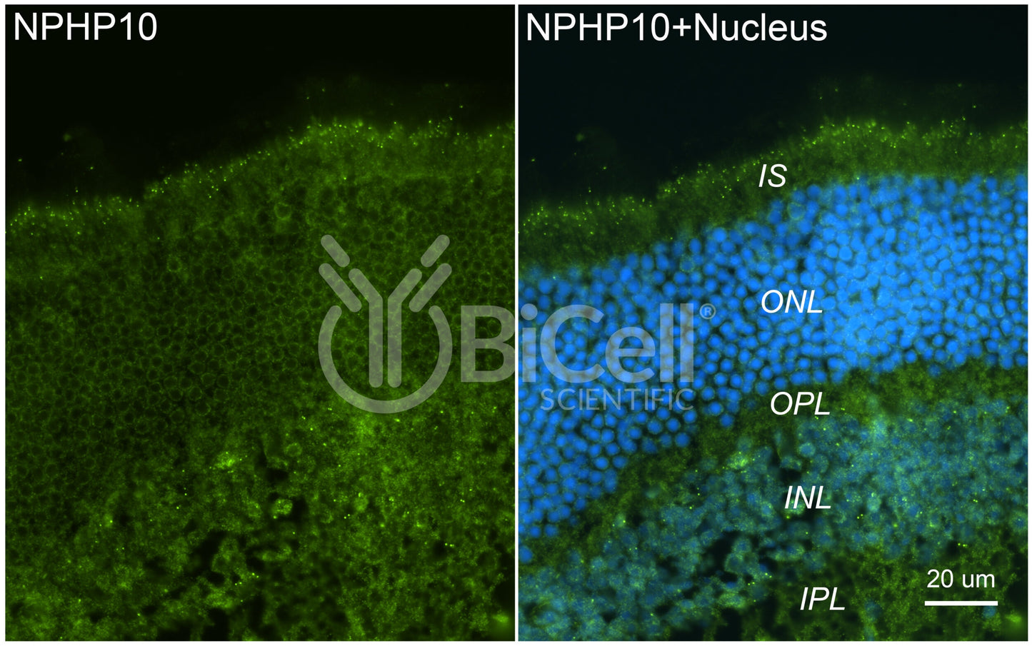 Nephrocystin-10 (NPHP10 or SDCCAG8 or BBS16) Antibody