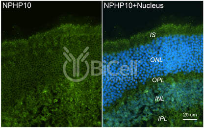 Nephrocystin-10 (NPHP10 or SDCCAG8 or BBS16) Antibody