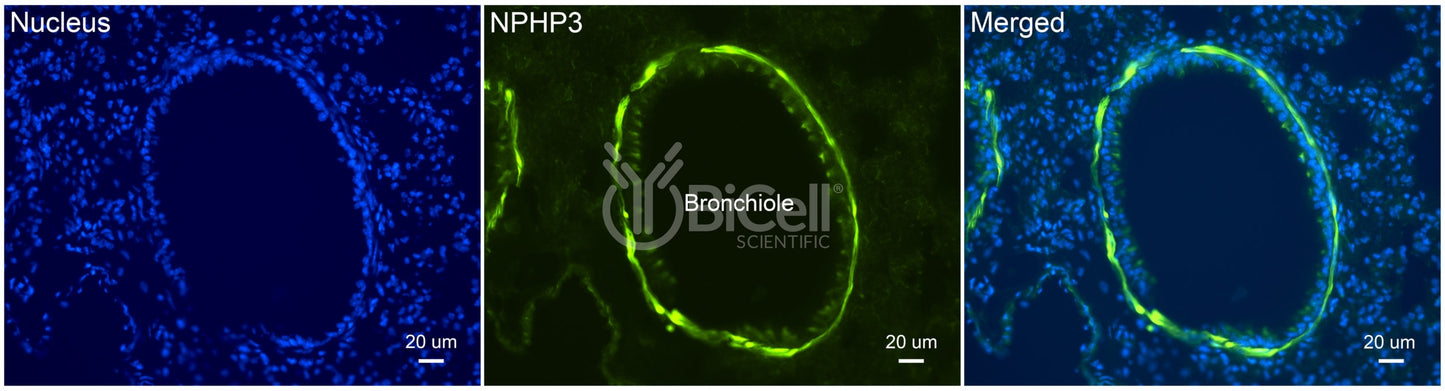 Nephrocystin-3 (NPHP3 or MKS7) Antibody
