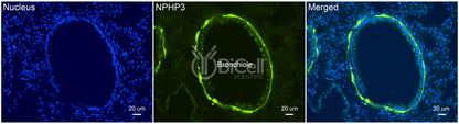 Nephrocystin-3 (NPHP3 or MKS7) Antibody