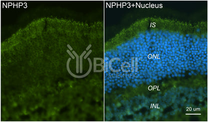 Nephrocystin-3 (NPHP3 or MKS7) Antibody