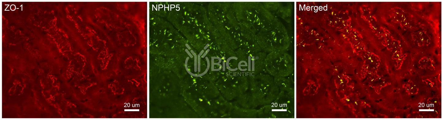 Nephrocystin-5 (NPHP5 or IQCB1) Antibody - FFPE Validated