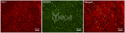 Nephrocystin-5 (NPHP5 or IQCB1) Antibody - FFPE Validated
