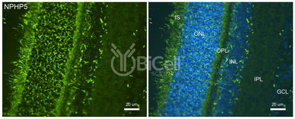 Nephrocystin-5 (NPHP5 or IQCB1) Antibody - FFPE Validated