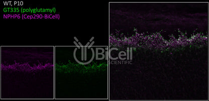 Nephrocystin-6 (NPHP6 or CEP290 or MKS4 or BBS14) Antibody - FFPE Validated