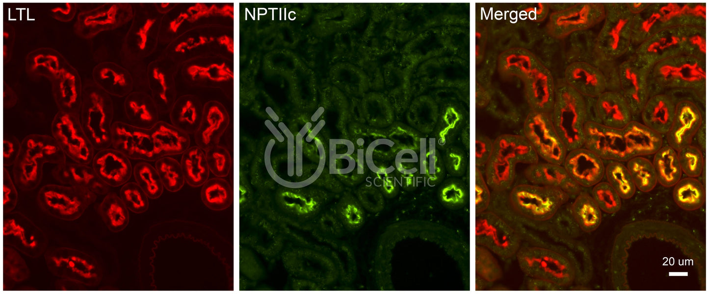 NPT2c (SLC34a3) Antibody