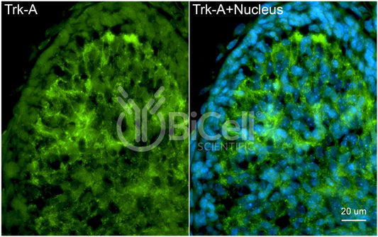 Trk-A (NTRK1) Antibody - FFPE Validated