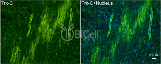 Trk-C (NTRK3) Antibody