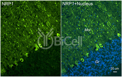 Neuropilin-1 (NRP1) Antibody