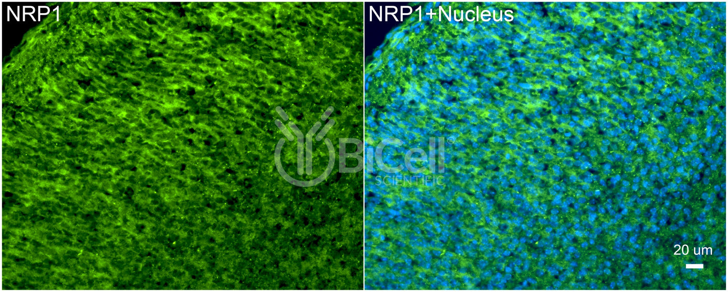 Neuropilin-1 (NRP1) Antibody - Western Blot Validated