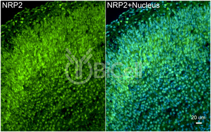 Neuropilin-2 (NRP2) Antibody - FFPE Validated