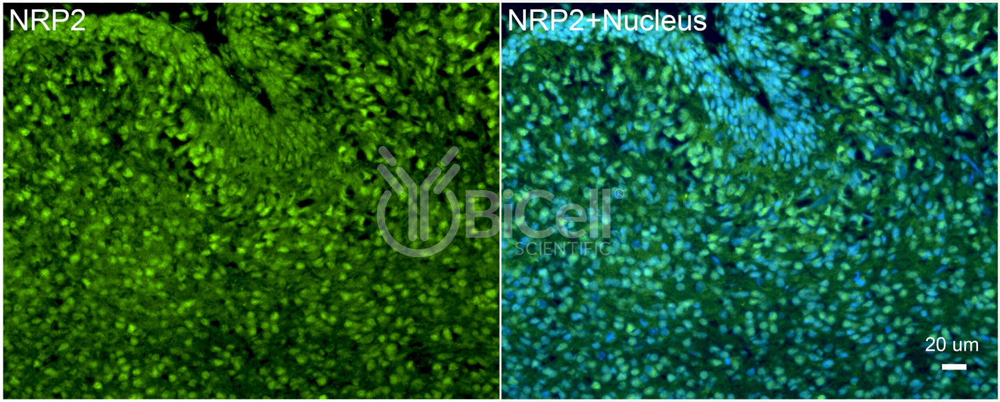 Neuropilin-2 (NRP2) Antibody - FFPE Validated