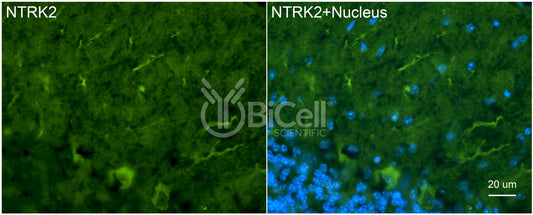 Trk-B (NTRK2) (N-Terminus) (Extracellular) Antibody - Western Blot Validated