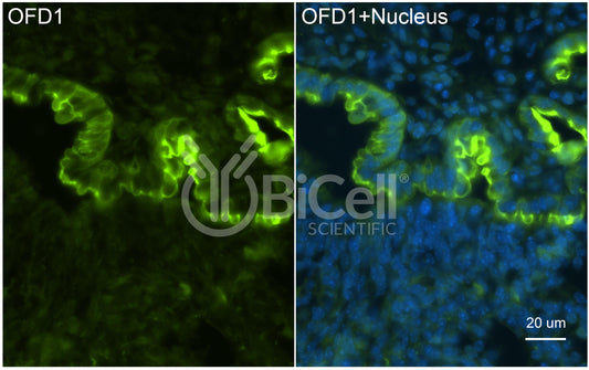 OFD1 Antibody - FFPE Validated