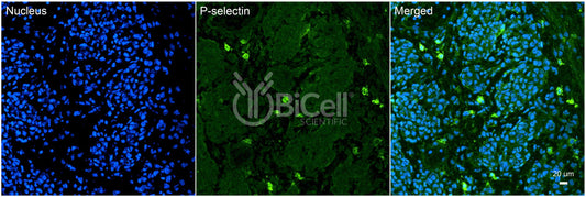 P-selectin (SELP or LECAM3 or CD62P) Antibody - FFPE Validated