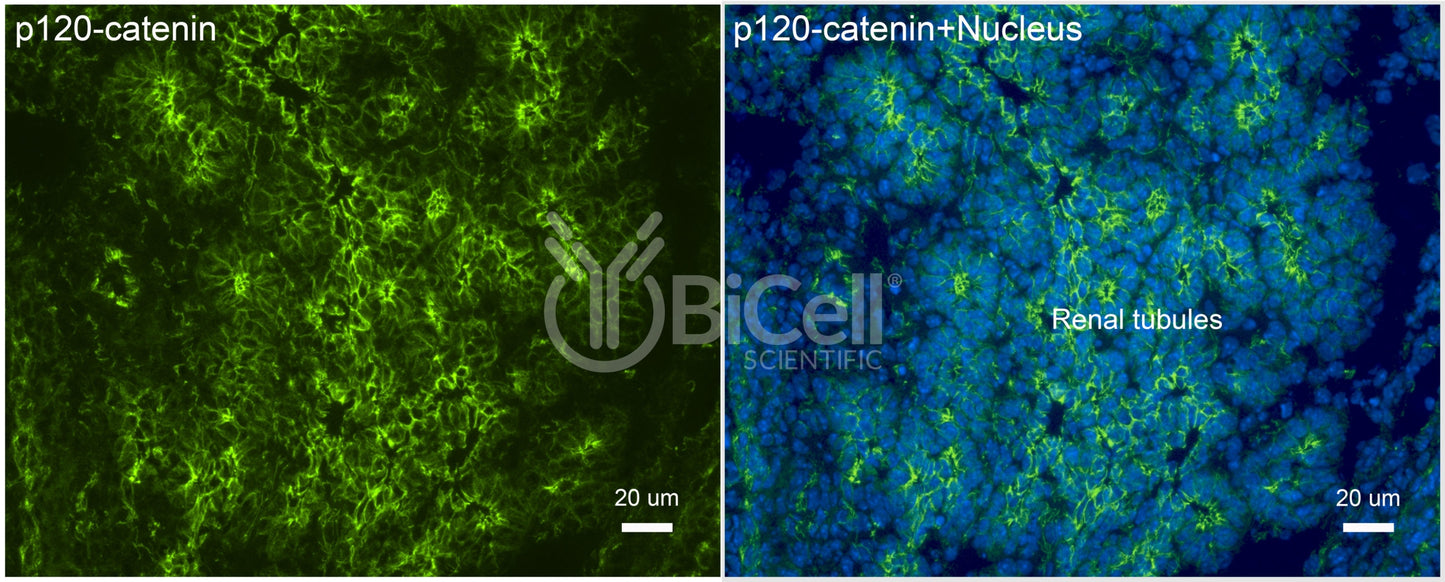 p120-catenin (Ctnnd1) Antibody - Western Blot Validated