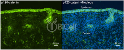 p120-catenin (Ctnnd1) Antibody - FFPE Validated