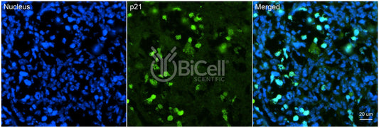 CDKN1A (P21 or P21CIP1 or CIP1) Antibody - FFPE Validated