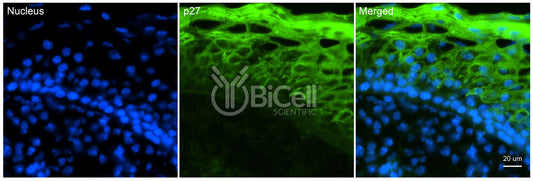 CDKN1B (P27 or P27KIP1 or KIP1) Antibody - Western Blot Validated