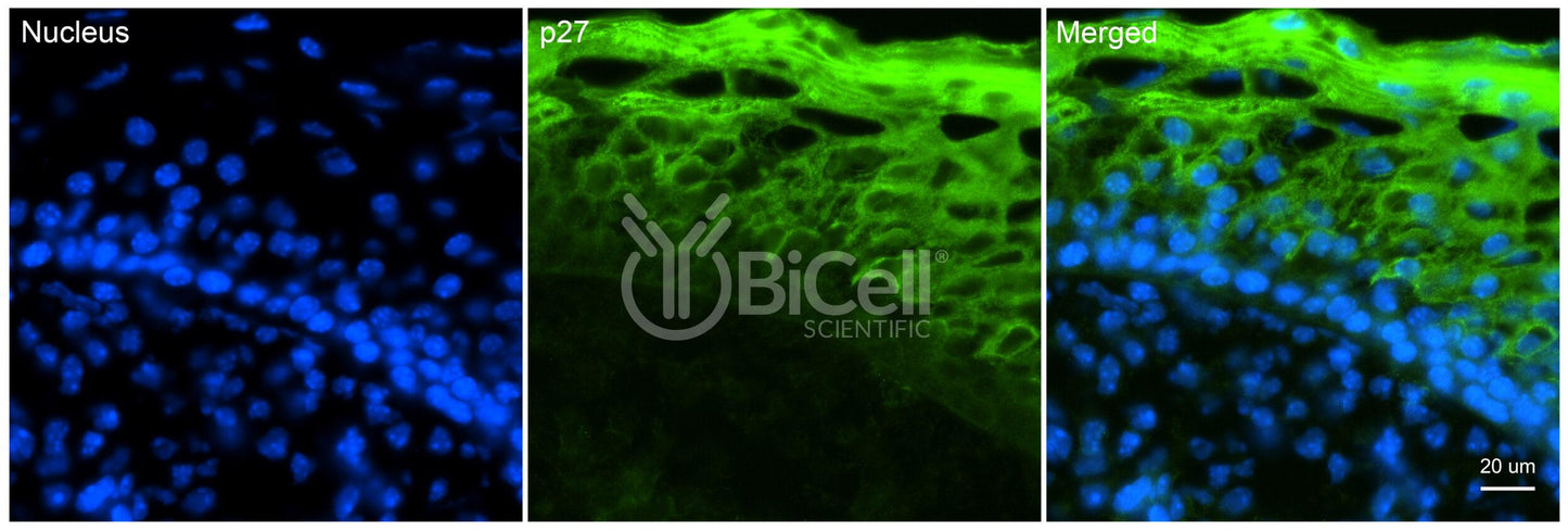 CDKN1B (P27 or P27KIP1 or KIP1) Antibody