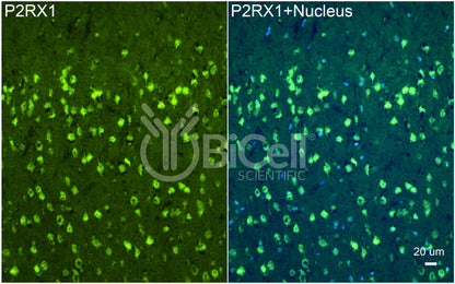 P2RX1 (P2X1) Antibody - Western Blot Validated