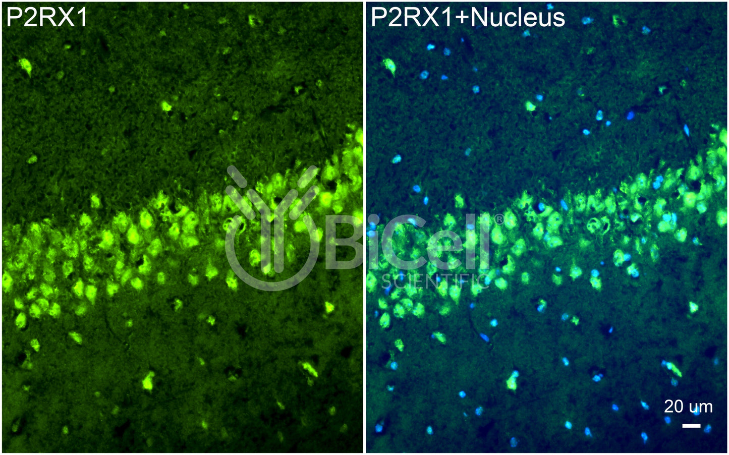 P2RX1 (P2X1) Antibody - FFPE Validated