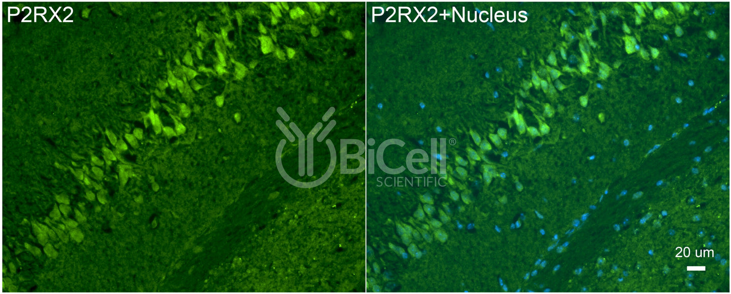 P2RX2 (P2X2) Antibody