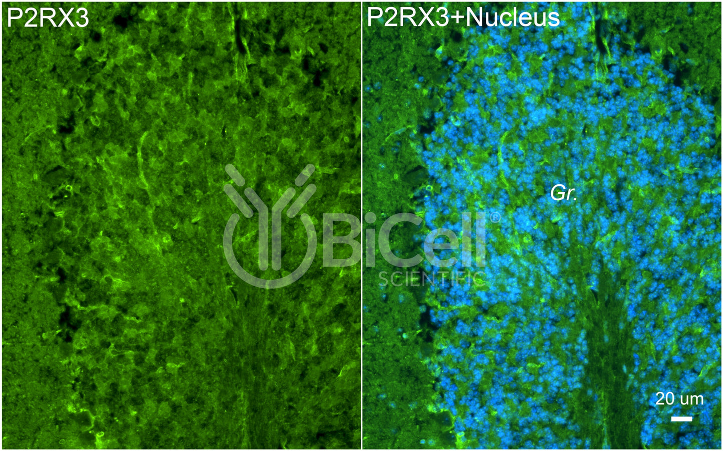 P2RX3 (P2X3) Antibody - FFPE Validated