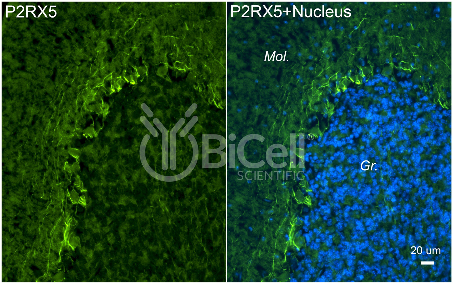 P2RX5 (P2X5) Antibody