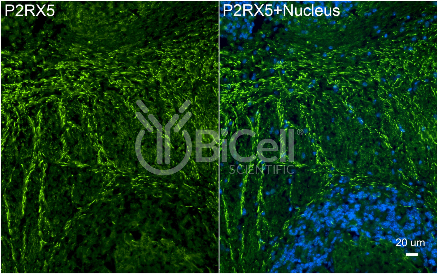 P2RX5 (P2X5) Antibody