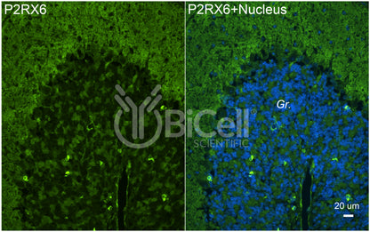 P2RX6 (P2X6) Antibody - FFPE Validated