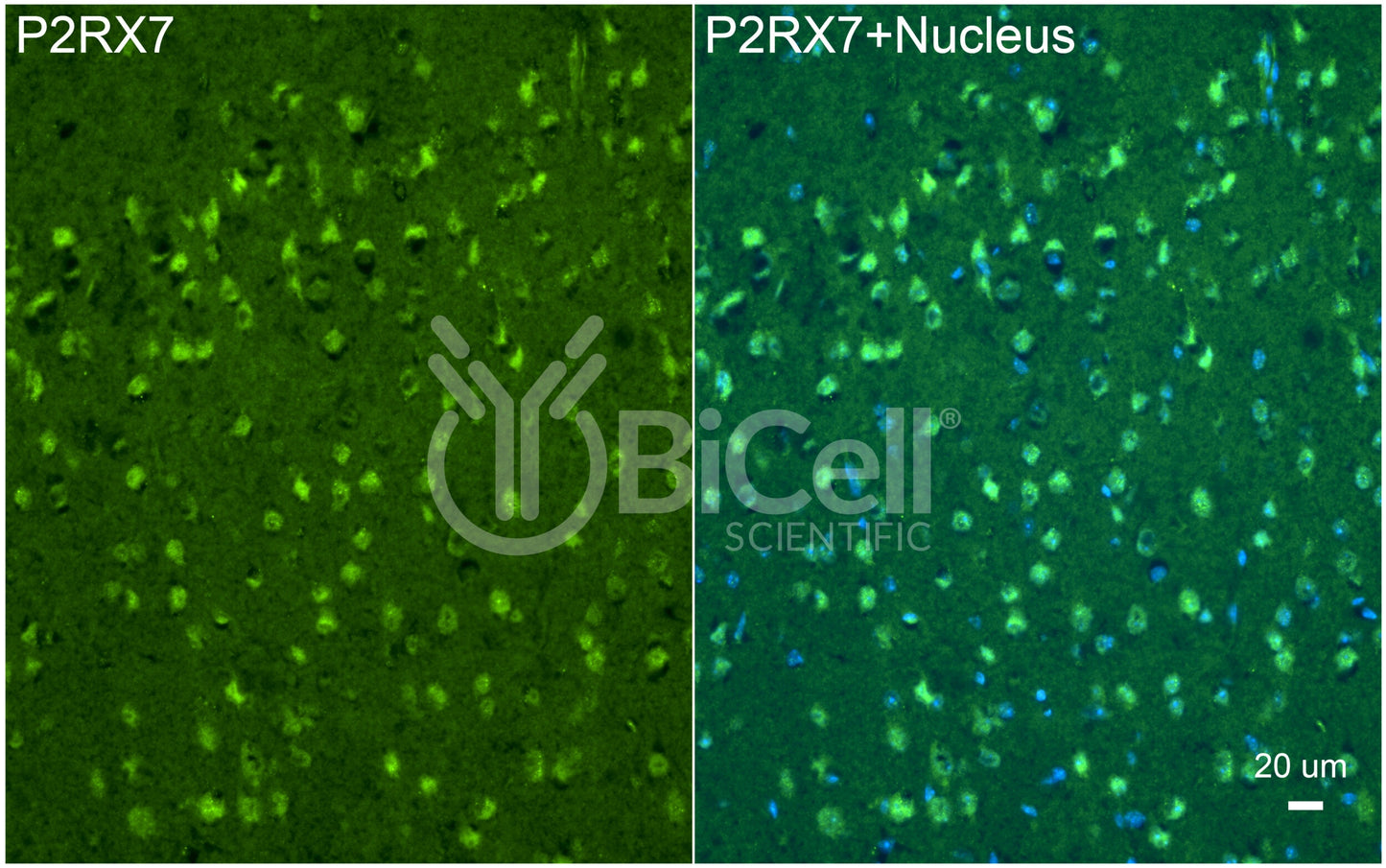 P2RX7 (P2X7) Antibody