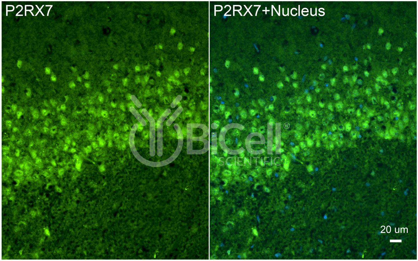 P2RX7 (P2X7) Antibody