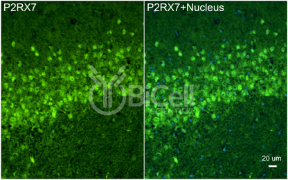 P2RX7 (P2X7) Antibody