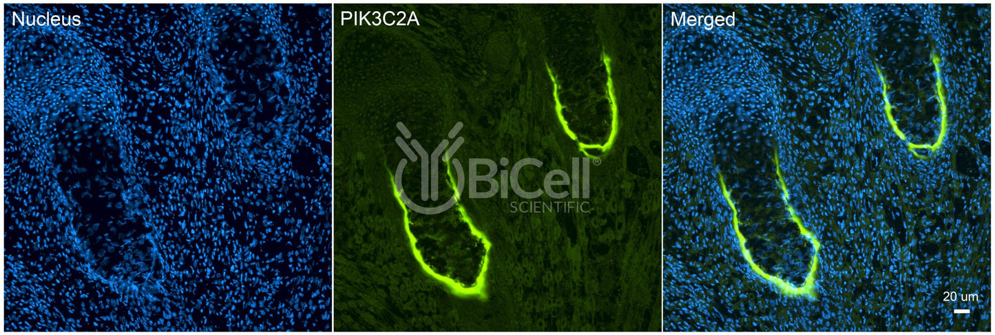 PIK3C2A (PI3K-C2-alpha or PI3-K-C2A) Antibody