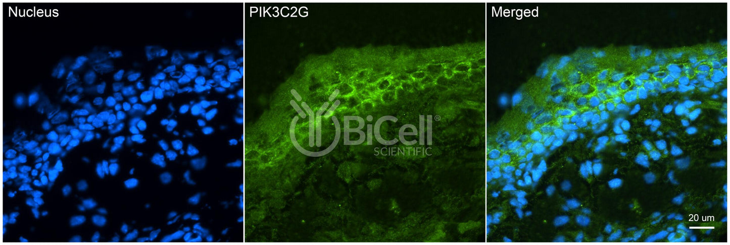 PIK3C2G (PI3K-C2-gamma) Antibody - FFPE Validated