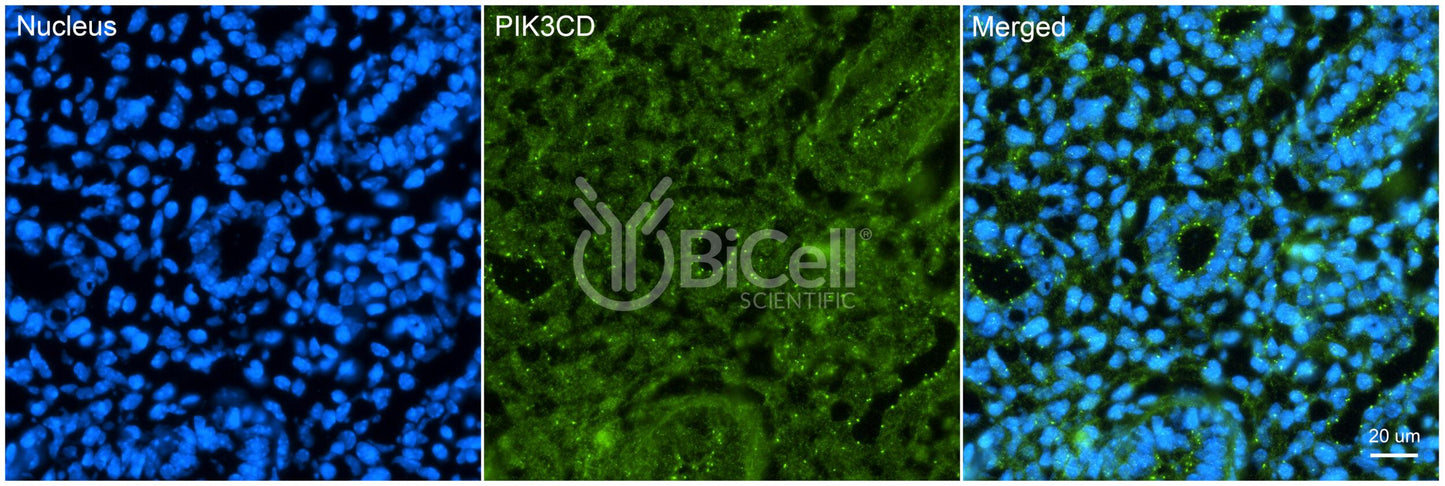 PIK3CD (P110DELTA or p110D) Antibody - Western Blot Validated