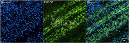 PIK3CD (P110DELTA or p110D) Antibody - Western Blot Validated