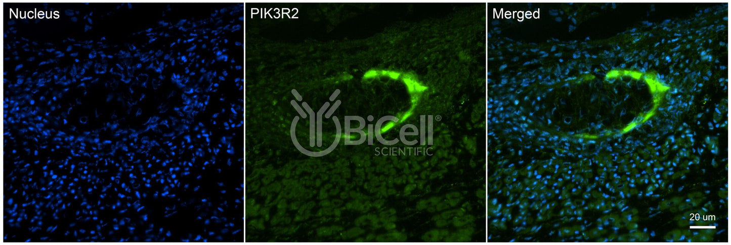 PIK3R2 (p85 or p85beta) Antibody - FFPE Validated