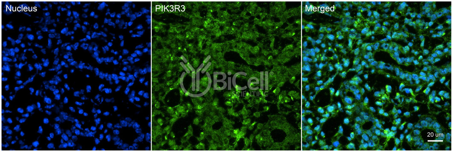 PIK3R3 (p55 or p55-GAMMA) Antibody - FFPE Validated