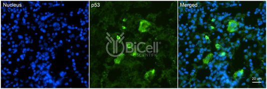 TP53 (P53) Antibody