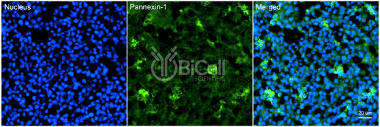 Pannexin-1 (PANX1) Antibody